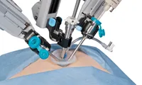 Robotics surgery benefits patients