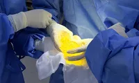 Silent breast implant rupture: what women should be aware of