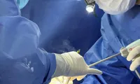 Breast augmentation 4 years ago – unexpected foreign body discovered in the breast
