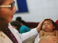 Virus Zika có thể nhân bản trong não trẻ