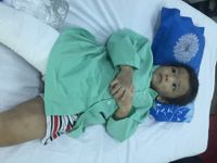 TP.HCM: Bé trai 4 tuổi bị cha dượng và mẹ bạo hành đến gẫy xương đùi