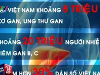 Hơn 20 triệu người nhiễm virus viêm gan B và C