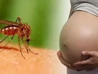 Thái Lan điều tra 4 trường hợp nghi mắc chứng đầu nhỏ do virus Zika
