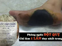 Thực hư về bài thuốc Đông y đắp bàn chân phòng ngừa độ quỵ