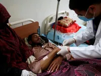 Báo động dịch tả tại Yemen