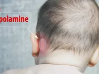 Cảnh b&aacute;o miếng d&aacute;n chống say xe g&acirc;y rối loạn t&acirc;m thần cho trẻ nhỏ