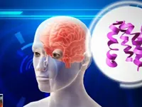 Ô nhiễm không khí làm tăng nguy cơ mắc Alzheimer