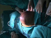 Phẫu thuật thành công ca mổ loại bỏ khối u tuyến vú khổng lồ