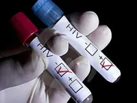 Công nghệ mới giúp phát hiện HIV chỉ sau 1 tuần phơi nhiễm