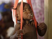 Hàng triệu trẻ em Sudan nguy cơ suy dinh dưỡng do thiếu nước sạch