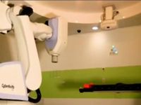 Hệ thống xạ trị bằng robot Cyberknife giúp loại bỏ các khối u não