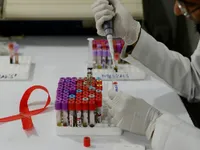 Cuba thử nghiệm vaccine điều trị HIV/AIDS