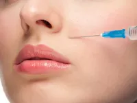 Tiêm filler thế nào mới an toàn?