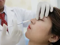 Thêm một vụ mù mắt vì tiêm filler