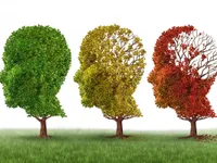 Thiếu ngủ làm tăng nguy cơ bệnh Alzheimer