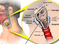 Nhận biết sớm ung thư thanh quản