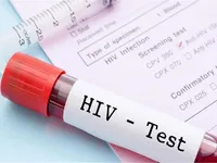 Sử dụng thuốc ARV đúng chỉ định sẽ ngăn ngừa lây nhiễm HIV