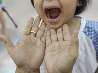 Hand, foot and mouth disease outbreak in Malaysia