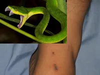 Cảnh b&aacute;o: rắn lục đu&ocirc;i đỏ tấn c&ocirc;ng người