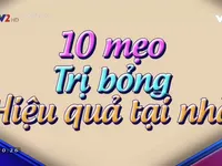 10 mẹo chữa bỏng tại nhà hiệu quả