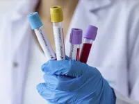 Brunei reports 134 COVID-19 cases as of April 3