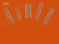 Australia đột phá trong sản xuất stent nhờ công nghệ in 3D