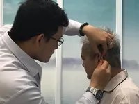 Institute's acupuncture treatment helps smoking addicts
