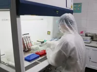 Vietnamese-made nCoV quick test kit completed