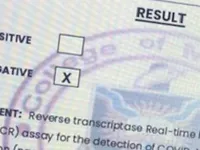 Europol cảnh báo về tình trạng làm giả giấy xác nhận âm tính với SARS-CoV-2