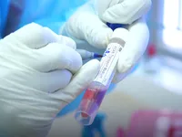 5 ca nghi nhiễm COVID-19 ở Thái Bình liên quan BV Bệnh Nhiệt đới Trung ương cơ sở 2