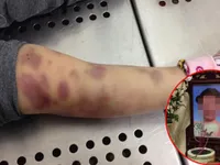 Mother and stepfather charged with murder of child