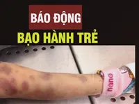 Vụ bé gái 8 tuổi bị bạo hành: Xin đừng lặng im!