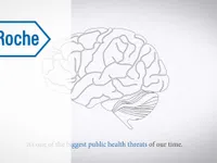 Roche hợp tác thử nghiệm phương pháp mới điều trị bệnh Alzheimer