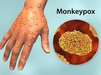 Có bằng chứng lây nhiễm virus đậu mùa khỉ từ người sang chó