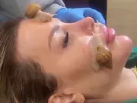 Chăm sóc da mặt bằng… ốc sên