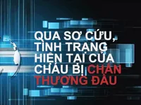 Vụ gọi điện lừa đảo 'con đang cấp cứu': Các đối tượng chia vai để cùng lừa dối phụ huynh