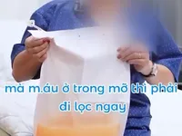 Bệnh viện quảng cáo lọc máu loại bỏ mỡ máu giúp giảm đột quỵ: Bộ Y tế yêu cầu làm rõ