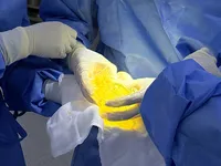 Silent breast implant rupture: what women should be aware of