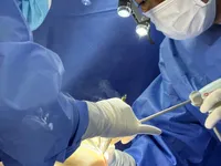 Breast augmentation 4 years ago – unexpected foreign body discovered in the breast