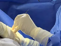 Causes of early breast implant rupture