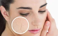 Tuyệt chiêu giúp làn da đẹp trong mùa đông