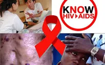 WHO đưa ra hướng dẫn mới phòng ngừa HIV/AIDS