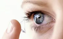 Những nguy hiểm khó lường khi dùng kính áp tròng