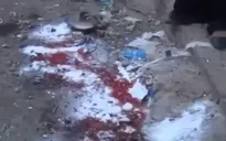 Trúng tên lửa, hàng chục người thương vong tại Yemen