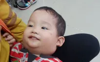 Bất lực nhìn con 2 tuổi lịm đi từng ngày