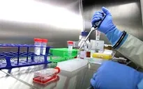 Tìm ra phương thức mới giúp vô hiệu hóa virus Ebola