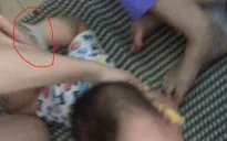 Vụ bé 15 tháng tuổi bị bạo hành: Trách nhiệm thuộc về ai?