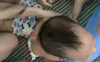 Khởi tố 2 giáo viên bạo hành trẻ tại Quảng Bình