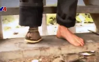 Nhiều dự án đem hỗ trợ cho nạn nhân bom mìn