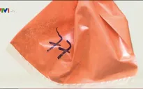 Nguy cơ tổn thương vĩnh viễn hệ thần kinh vì nhiễm độc chì từ thuốc cam